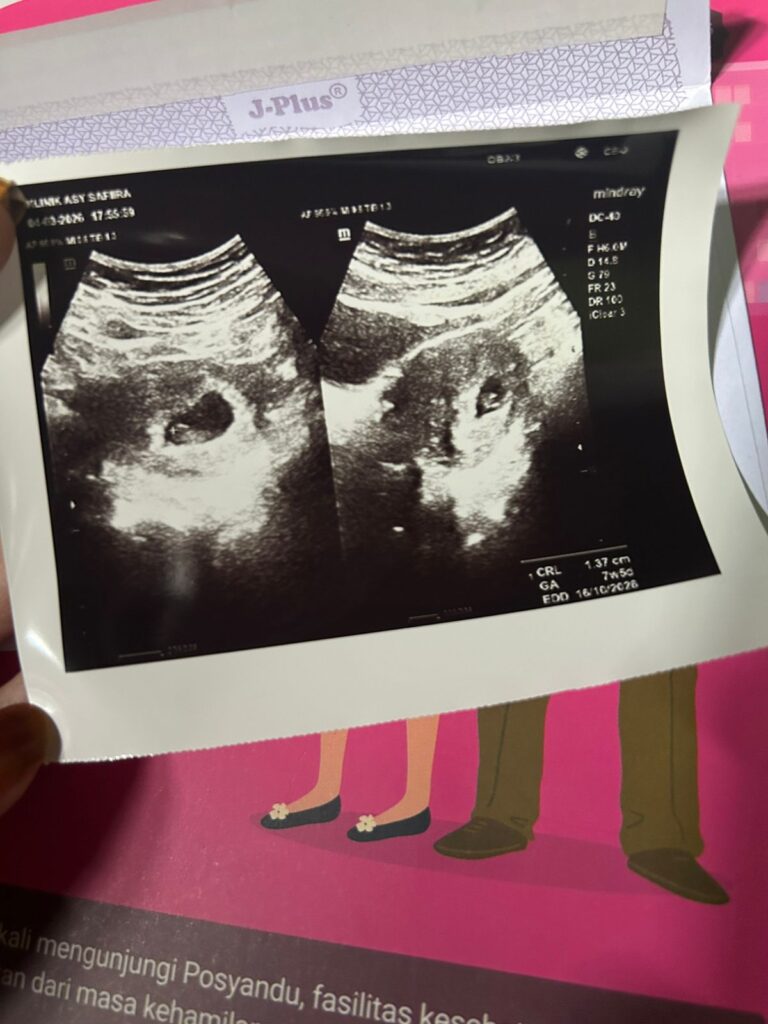 Udin & fanny love (7)